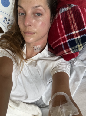 A woman takes a selfie while lying down in a hospital bed. She's wearing a white gown, and we can see various bandages, tubes, and IVs. Her head is resting on a red flannel pillow.